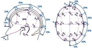  Rozmieszczenie elektrod zgodnie ze standardem Systemu 10-20