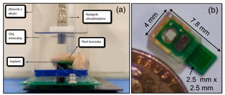 Ultradźwiękowe zasilanie implantu